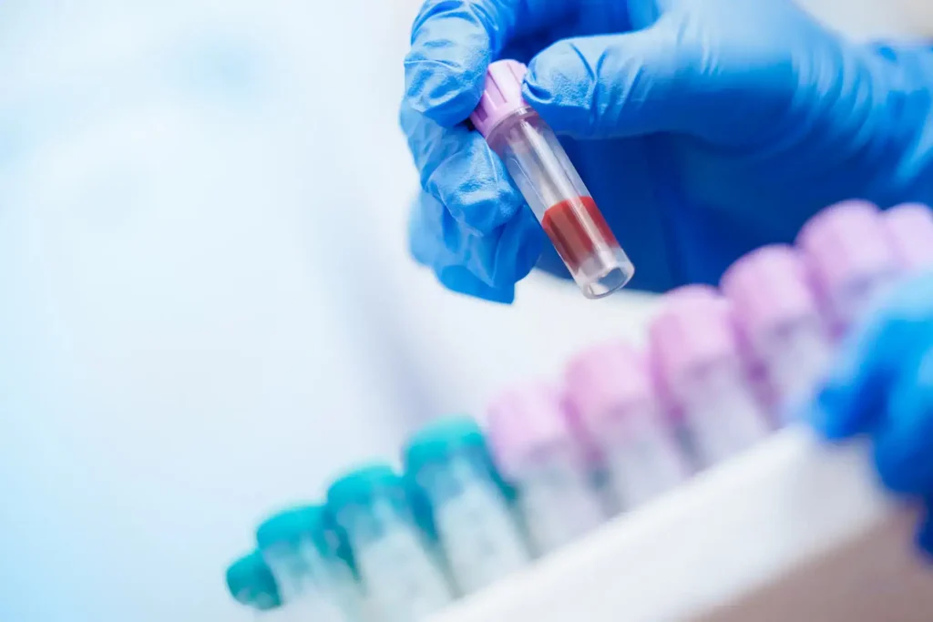 Laboratory technician handling blood sample test tube with gloves.